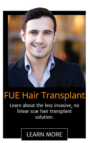 fue-hair-transplant-chicago